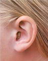 Co je to tinnitus?